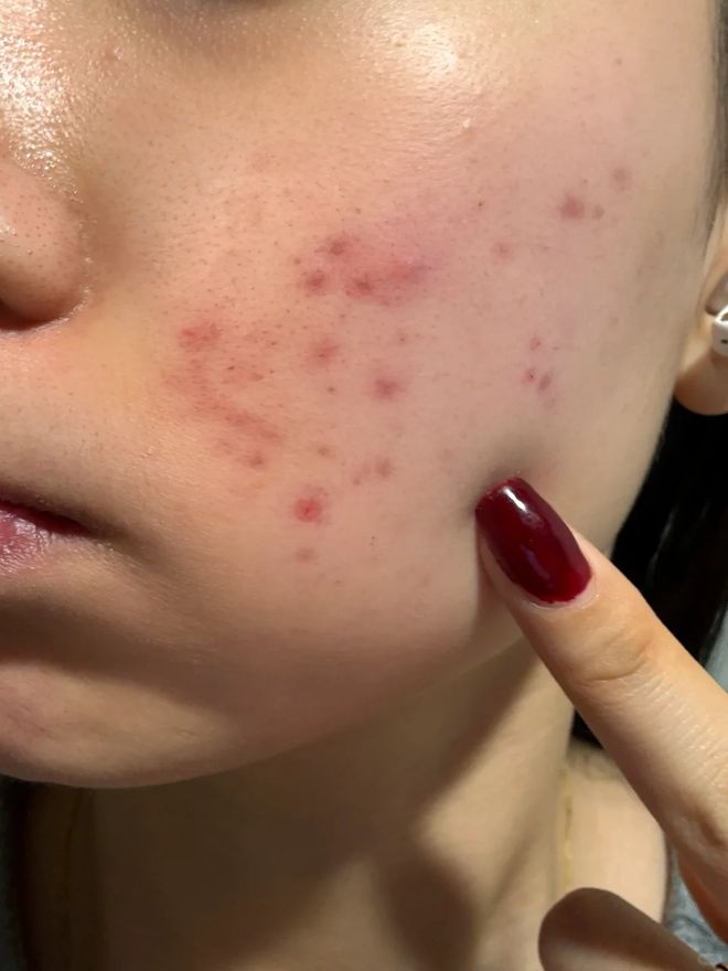 了？这种毛巾建议马上换掉新葡京你家的毛巾多久没换(图12)