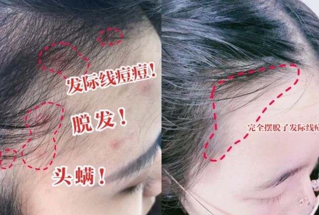 好？10分钟轻松养成女明星「绸缎发」新葡京娱乐城洗完头自然风干还是吹干(图11)